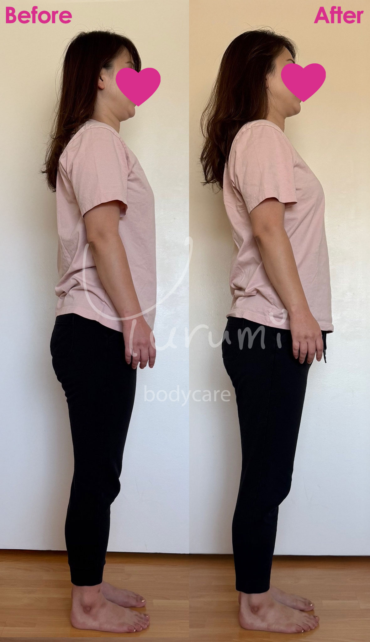Before After