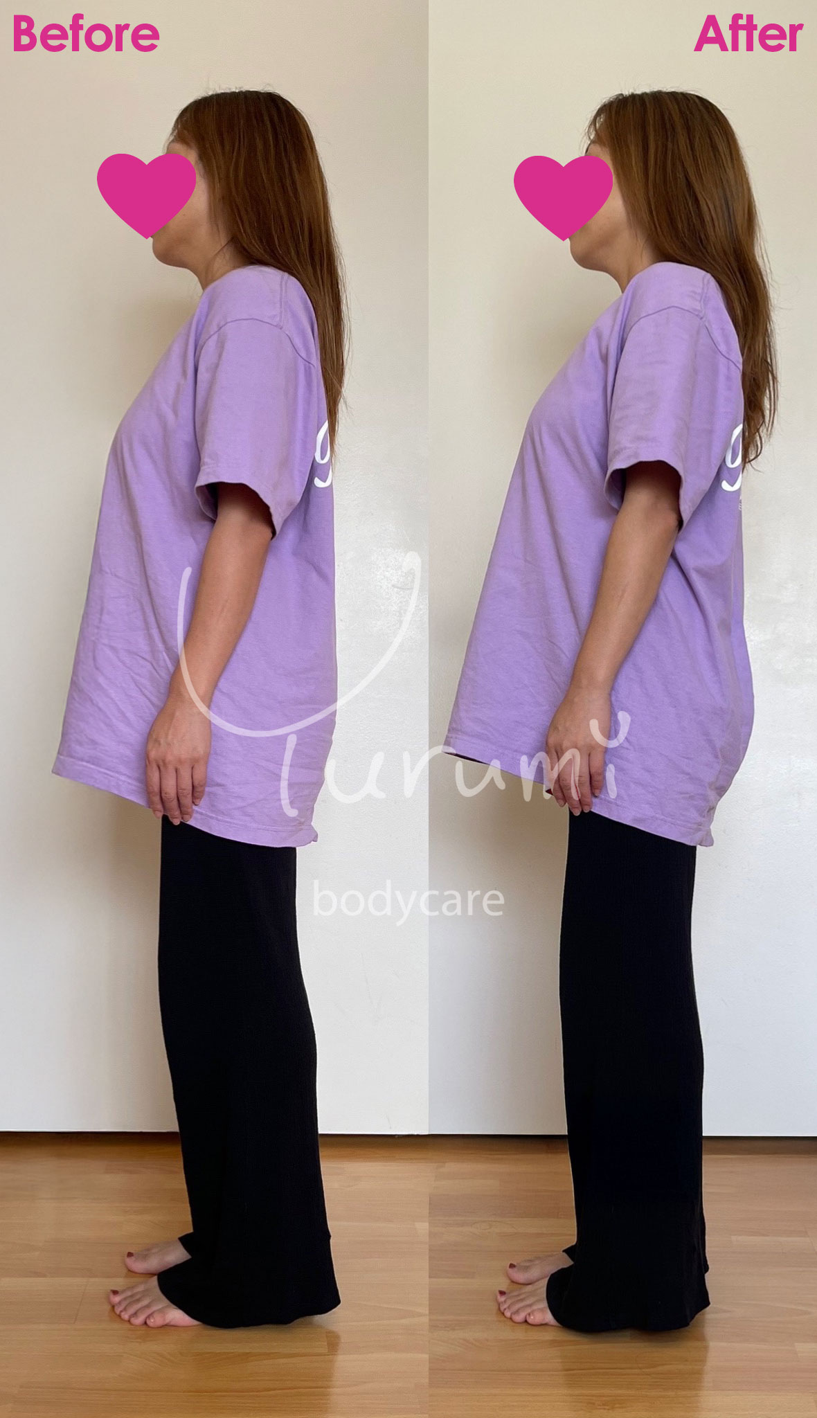 Before After