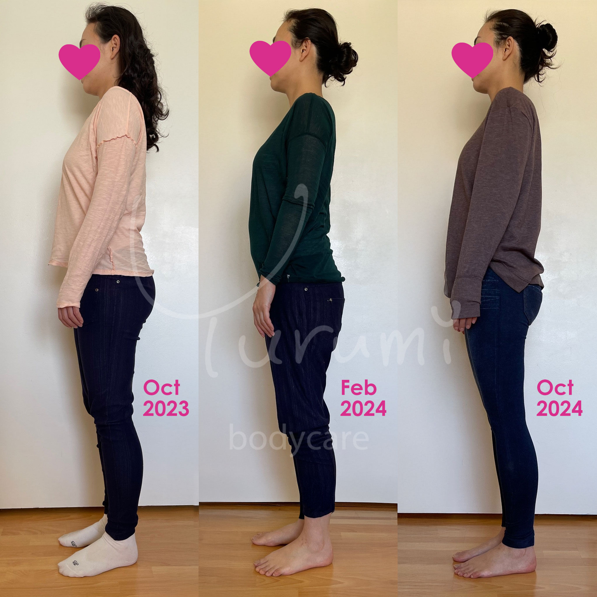 Before After